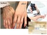 限定5名様【ハンドケア】ヒト幹細胞入り美容液導入ハンドケア★お試し¥11,000