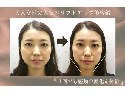 アザブハリーク(AZABU HARIEQ)の写真