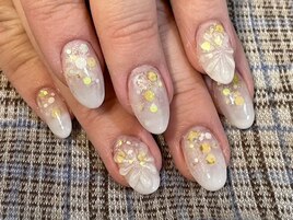 スカルプ埋め込みネイル