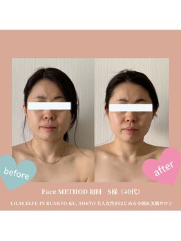 リラブルー(Lilas Bleu)/小顔メソッドで丸い幼顔に