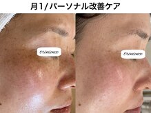 トリニエンス 南流山店/40代/肌質改善/艶肌