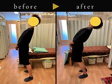 杉本接骨鍼灸院/背骨から全身がユルユル整体