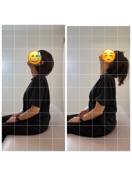 ナオル整体 恵比寿院(NAORU整体)/恵比寿/整体事例【首肩コリ】