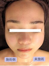 ボディーワークスナビ(Body Works Navi)/丸顔から卒業！凛とした印象に