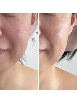 リトリート(Retreat)/フェイシャル80分