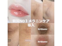 ブリランテ(Brillante)