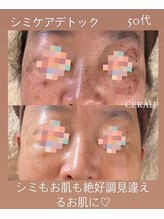 リラクゼーションルーム チュラ(Relaxation Room CERAH)/