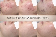 カプロ ボゥ(Capullo.Beau)