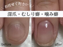 アメジスト(Amethyst)