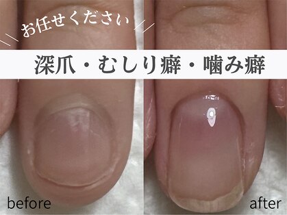 アメジスト(Amethyst)の写真