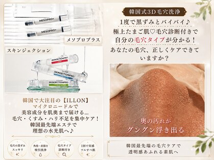 ダイヤモンド リーエンダ(Diamond leende)の写真