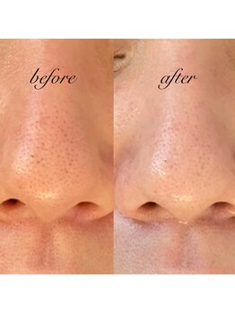 ルミア(Rumia)/美肌・小顔・毛穴美人♪