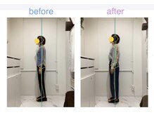 レピア 夙川本店(Lepia)/ビフォーアフターのご紹介♪