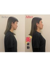 池袋東口整体院/【ビフォーアフター3】美容整体