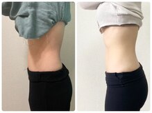 ゆうきや整体院/ぽっこりお腹解消！整体+キャビ