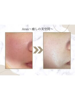 お肌をきれいにしたい