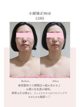 トゥインクル 麻布(twinkle)/港区/南麻布/麻布十番/小顔矯正