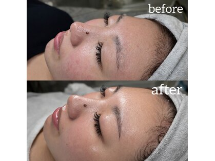 セナ(SENA)の写真