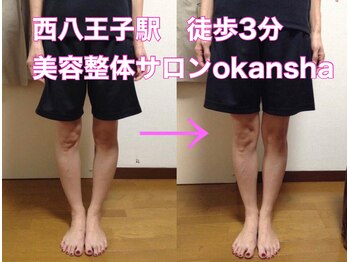 美容整体サロン オオカンシャ(okansha)/O脚BeforeAfter♪