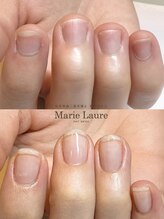 マリーロール 梅田店(Marie Laure)/自爪育成/深爪矯正/ネイルケア