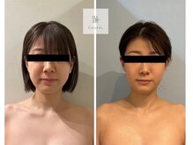 マナ(Mana)の雰囲気（速攻実感◎小顔）