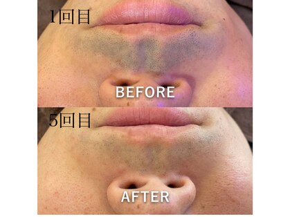 アルマース(Arumasu)の写真