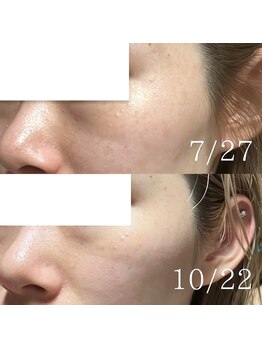 てづか整骨院 美咲が丘院/【サロン】ホームケア