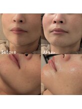 サロン ド モミカル(salon de momikaru)/