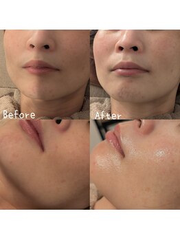 サロン ド モミカル(salon de momikaru)/