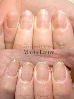 マリーロール 淀屋橋本店(Marie Laure)/自爪育成/深爪矯正/ネイルケア