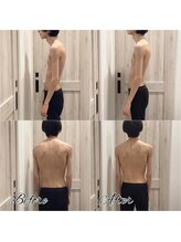 B.B藤沢 レオスタイル(LeoStyle)/ストレートネックが体の不調に