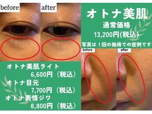 アクティブエイジングの雰囲気(エンビロンメニューでの症例写真★お悩みに応じてご選択可能♪)