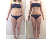 リラパドマ 千葉店(Rela Padma)/激痩せ短期集中ダイエットコース