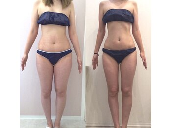 リラパドマ 千葉店(Rela Padma)/激痩せ短期集中ダイエットコース