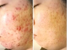 アンジェロの雰囲気（あなただけの専属エステティシャンが習慣化を徹底フォロー◎）