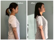 テルケル 佐賀/