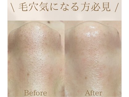 フォルチェ ゆめタウン広島店(Folche)の写真