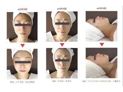 サロンドアンマンの写真