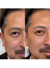 メンズ眉毛サロン&毛穴洗浄 HAK.大阪心斎橋【ハク】MEN'Sアイブロウサロン/眉毛パーマ/