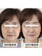 エミニナル(EMININAL)の写真/年齢によるお悩みに特化（たるみ・ほうれい線改善）