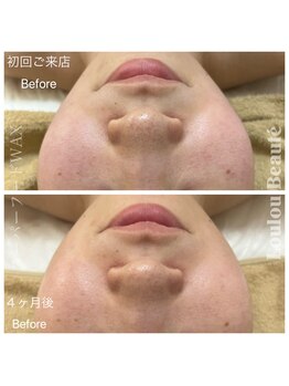 ルルボーテ(Loulou Beaute)/waxxxx