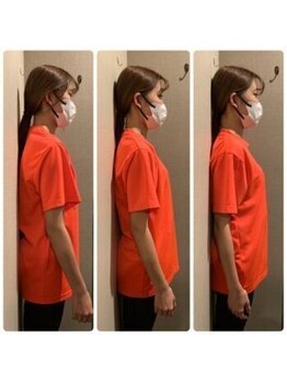 池袋東口整体院/【ビフォーアフター4】猫背改善