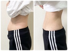 ゆうきや整体院/ぽっこりお腹解消！整体+キャビ