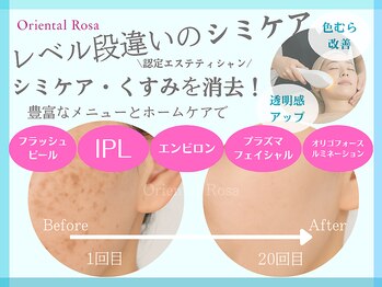 オリエンタルローザ 表参道(Oriental Rosa)/IPL表参道シミケ渋谷シミ改善