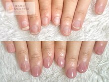 ココモ(cocomo)/深爪長さだしフィルイン自爪育成