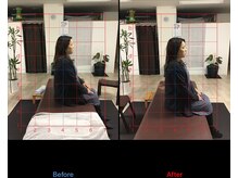 ストレチックス 近江八幡店/姿勢改善ビフォーアフター1回