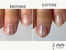 トトヘアー アンド ネイル(toto hair and nail)/【toto式】自爪育成 貝爪改善