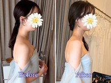 押上やまき整体の雰囲気（首すじが伸びて、フェイスラインまでスッキリ美しく。）