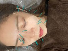 かがやき骨盤整体院 新大阪/施術風景