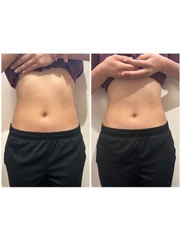 池袋東口整体院/【ビフォーアフター5】痩身